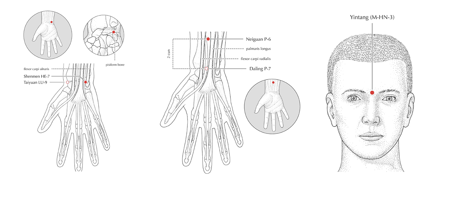 A Traditional Chinese Medicine Perspective on Sleep