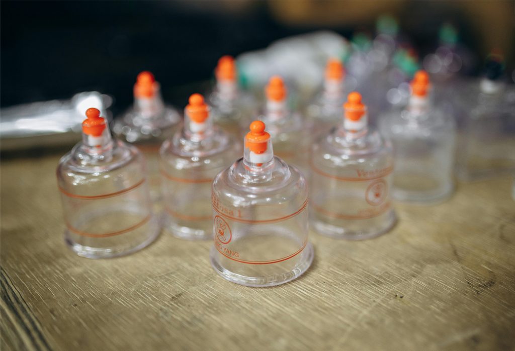 Professional Cupping Therapy Courses are available at Touch Tuina