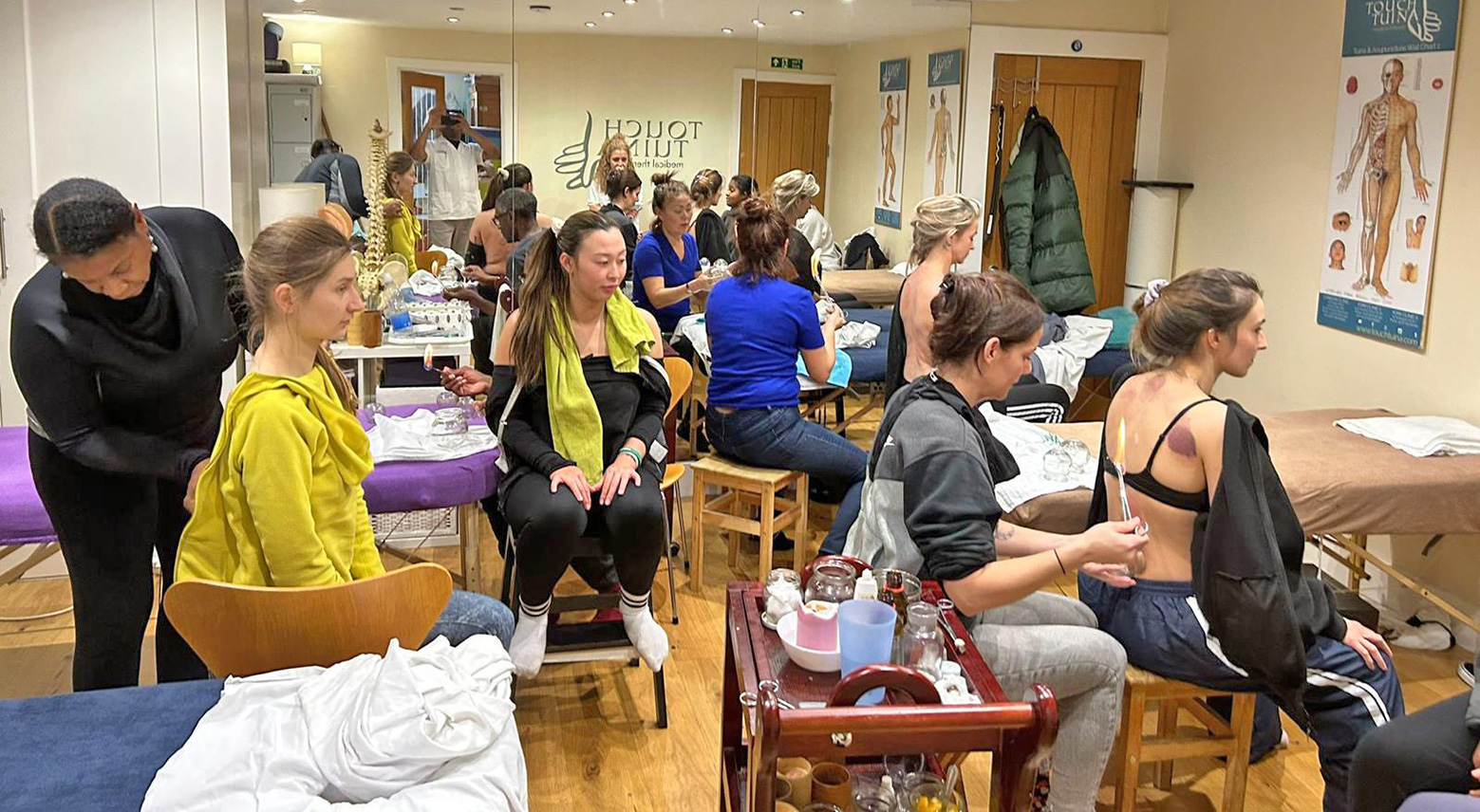 Teaching cupping at Touch Tuina London